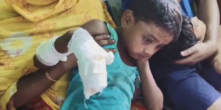 Murshidabad News: বল ভেবে খেলতে গিয়ে বিপত্তি, বোমা ফেটে জখম শিশু